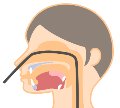 経鼻内視鏡